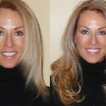 1297814839_blond-before-after-keratin-hair-extensions
