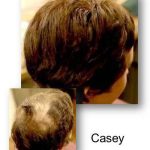 Before & After Casey