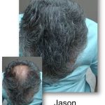 Before & After Jason