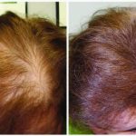 Hair Banger before and After