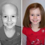 Lisa before & after